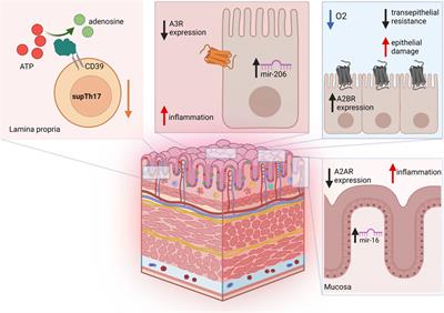 Adenosine-mediated immune responses in inflammatory bowel disease